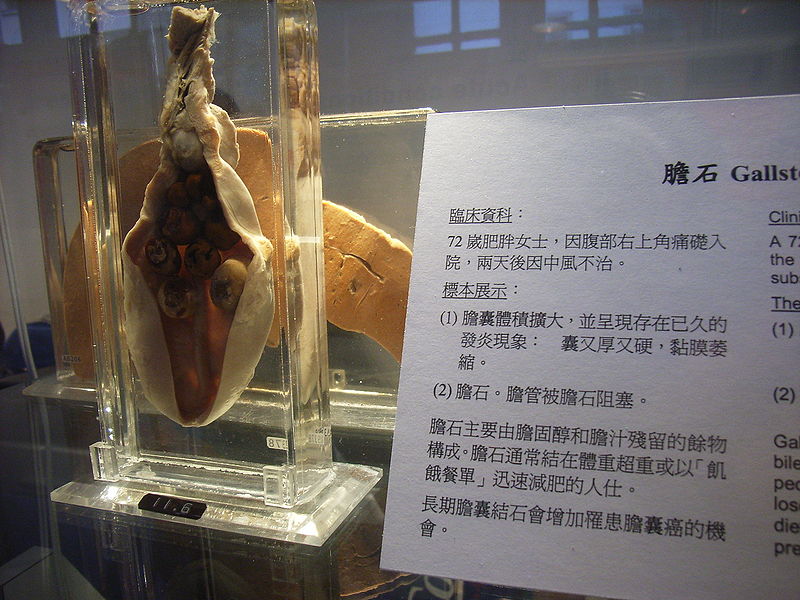 Hong Kong Museum of Medical Sciences